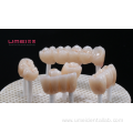 Zirconia bridge